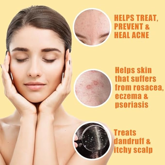 Herblov CLEANSING 10% SULFUR SOAP BAR FOR FACE & BODY  NATURAL SHINE CONTROL FACIAL CLEANSER FOR ACNE, OILY SKIN  MADE IN USA HEALING SKINCARE WASH WITH LEMONGRASS, TEA TREE OIL, VITAMIN E, COCONUT MILK - Image 3